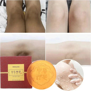 Soap Body Whitening Soap Deep Clean Skin Chicken Skin Removal